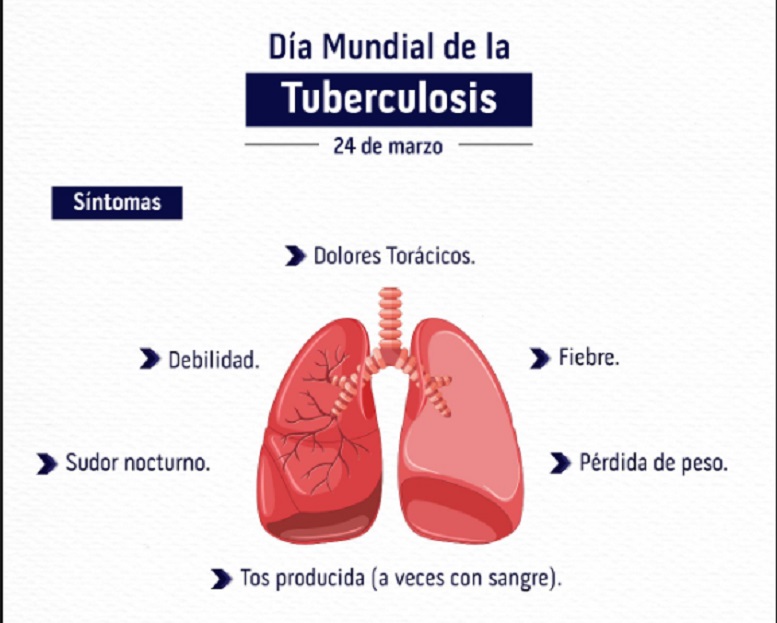 Marta Santi: hoy podemos encontrar casos de Tuberculosis en cualquier paciente