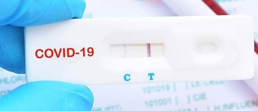 PROHIBICI&Oacute;N DE VENTA AL P&Uacute;BLICO DE TEST COVID-19 EN FARMACIAS DE LA PROVINCIA DE C&Oacute;RDOBA