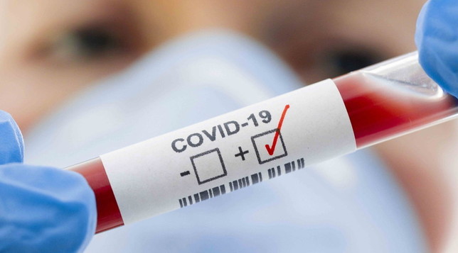 Nuevo r&eacute;cord de casos: 29.472 personas fueron diagnosticadas con coronavirus en el pa&iacute;s
