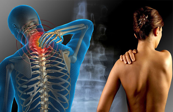 FIBROMIALGIA: UNA ENFERMEDAD QUE PUEDE SER INCAPACITANTE