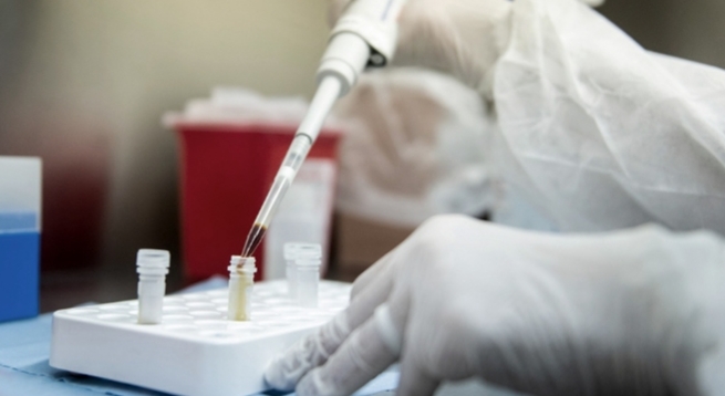 Argentina fue elegida para probar una vacuna contra el coronavirus