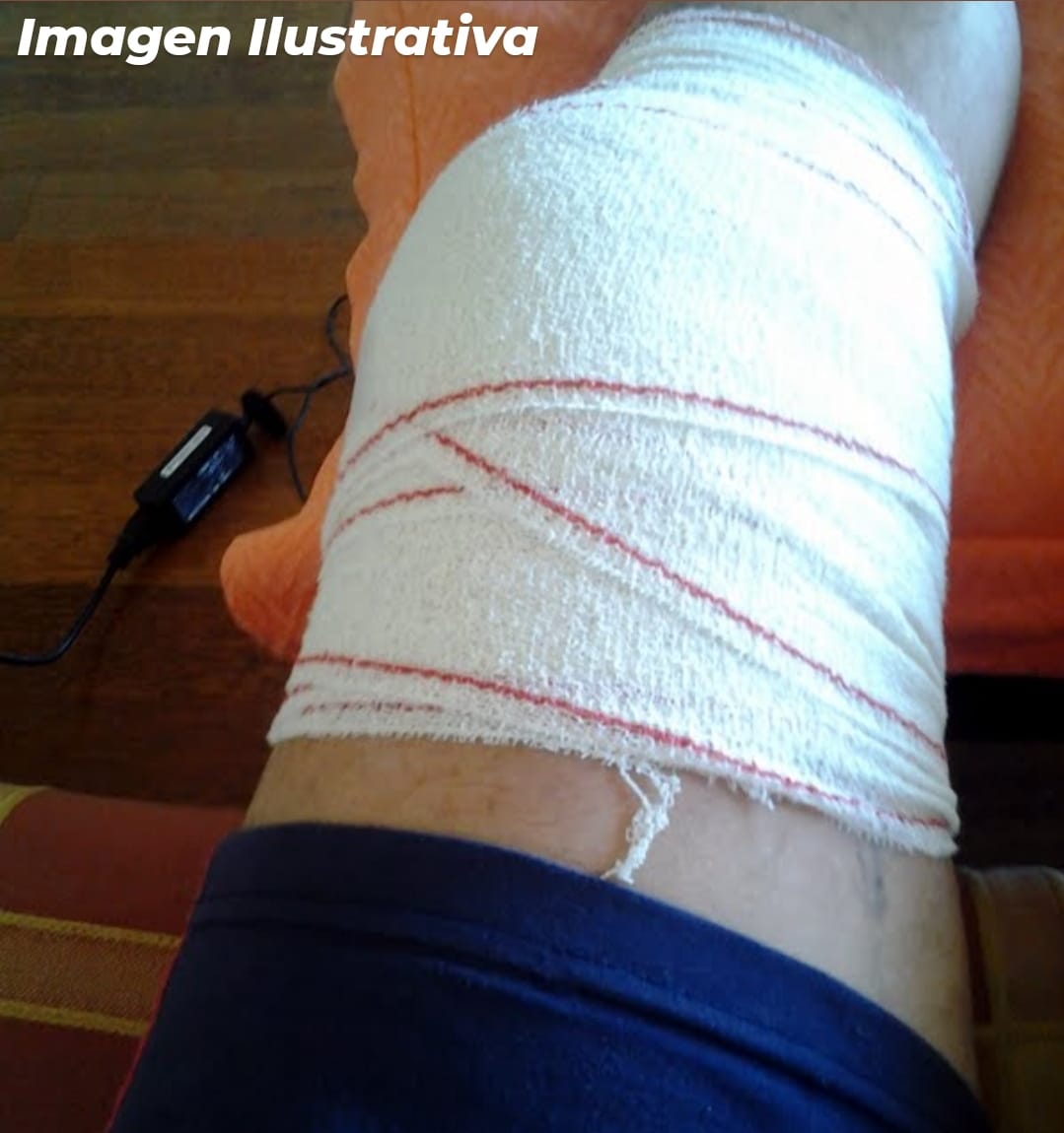 VERSIONES CRUZADAS: ABOGADO DEL PACIENTE DICE QUE SE EQUIVOCARON DE PIERNA AL OPERAR Y EL M&Eacute;DICO SOSTENDR&Iacute;A QUE NO ES VERDAD