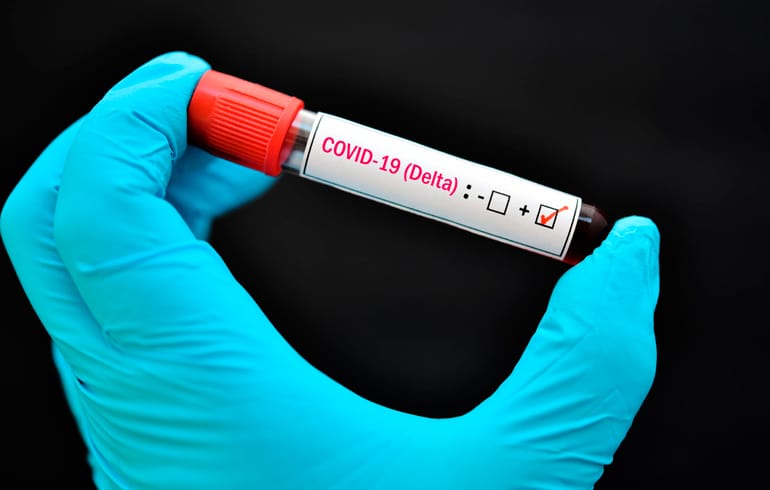 CORONAVIRUS: Hay 17 casos de la variante Delta en C&oacute;rdoba y, por ahora, descartan circulaci&oacute;n comunitaria