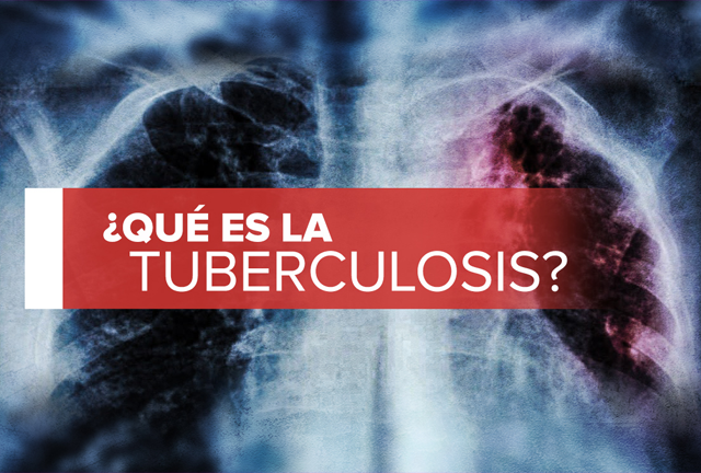 Tuberculosis: qué es y cómo se contagia