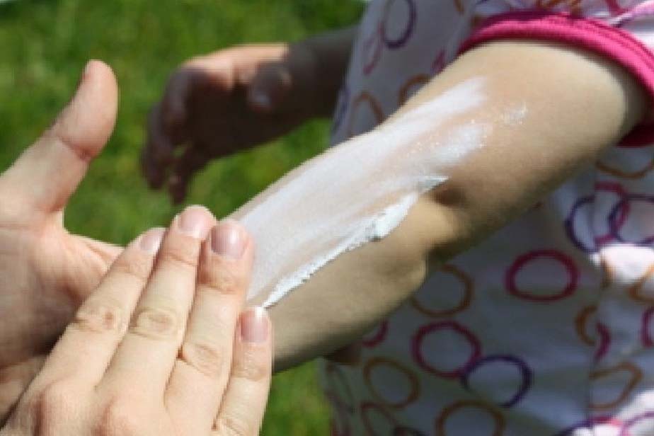 Altas temperaturas: recomiendan intensificar el cuidado de la piel al exponerse al sol