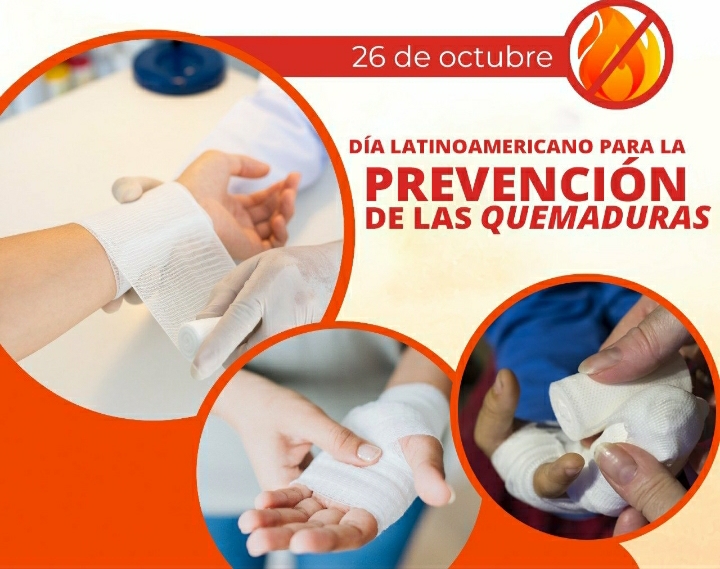 D&Iacute;A INTERNACIONAL DE LA PREVENCI&Oacute;N DE QUEMADURAS: LA IMPORTANCIA DE CUIDARSE DEL SOL
