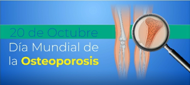 EL M&Eacute;DICO ERICK JOLICOEUR HABL&Oacute; DE LA IMPORTANCIA DE PREVENIR LA OSTEOPOROSIS