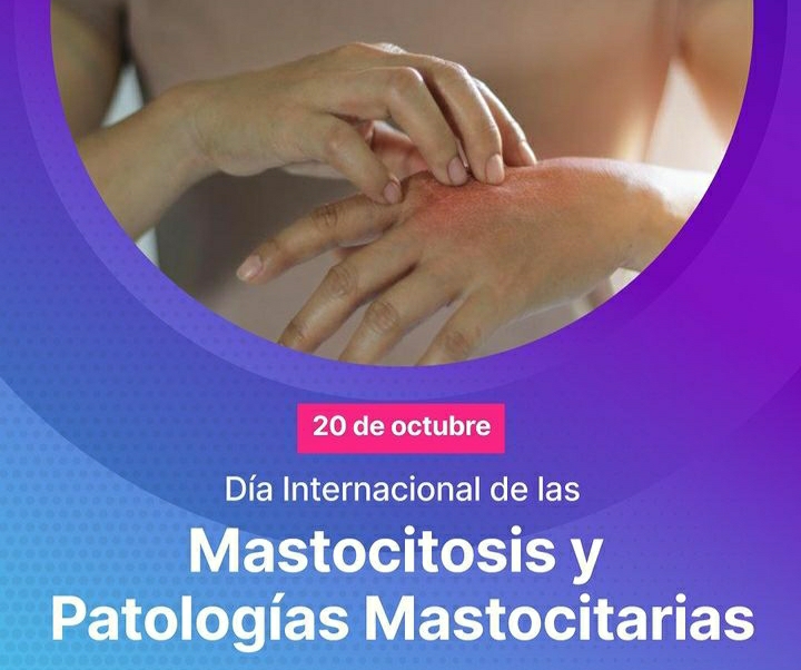 EN EL DIA INTERNACIONAL DE LAS MASTOCITOSIS HABLAMOS CON LA DERMAT&Oacute;LOGA JULIETA PETRUZZI
