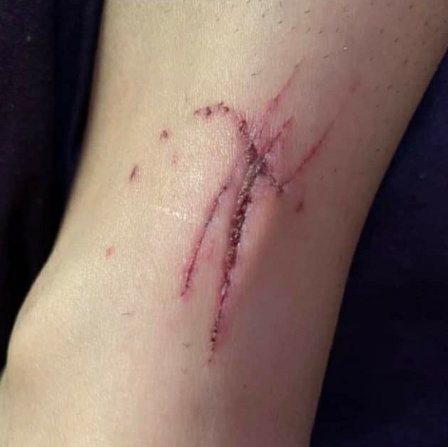 UN NI&Ntilde;O Y SU PAP&Aacute; FUERON MORDIDOS EL S&Aacute;BADO EN EL DIQUE PIEDRAS MORAS